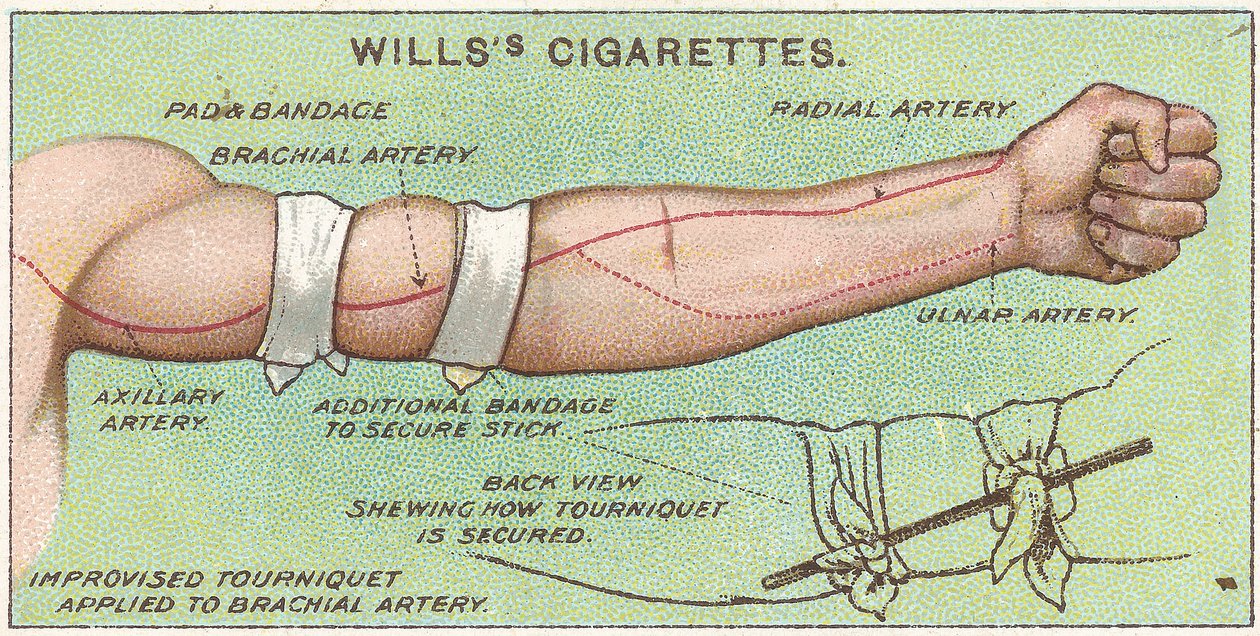 Tourniquet, 11. sz. a Willss Cigarettes kártya elsősegély-sorozatából, 1913 alkotó: English School