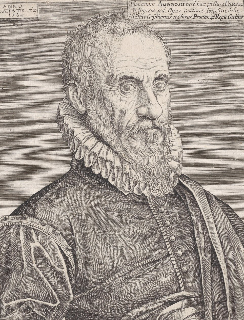 Ambroise Paré, a király sebészének portréja, 1582. alkotó: Etienne Delaune
