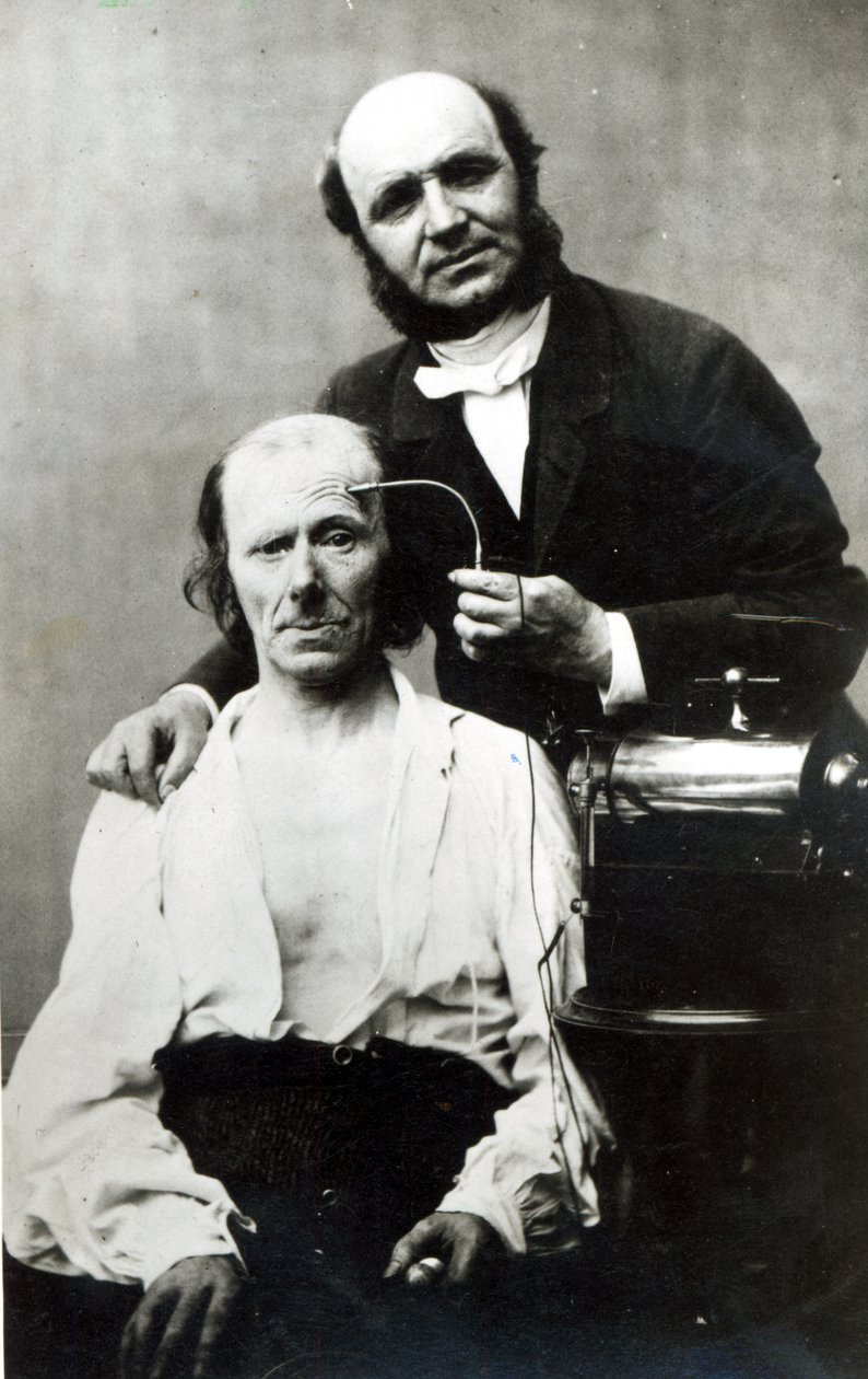 Duchenne de Boulogne áldozati beteggel, 1862 alkotó: French Photographer