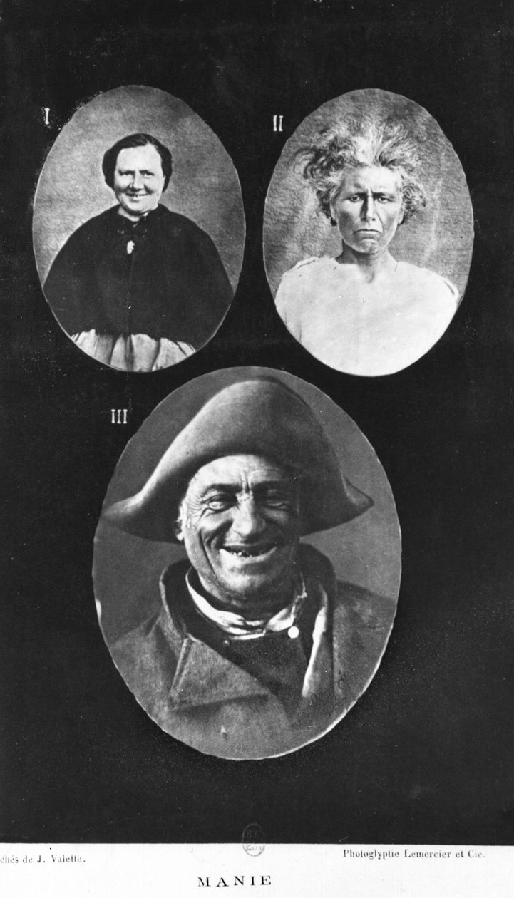 Mánia, illusztráció Henri Dagonet (1823-1902) mentális betegségekről szóló új elemi és gyakorlati értekezéséből, Paris, Bailliere, 1876 alkotó: French Photographer