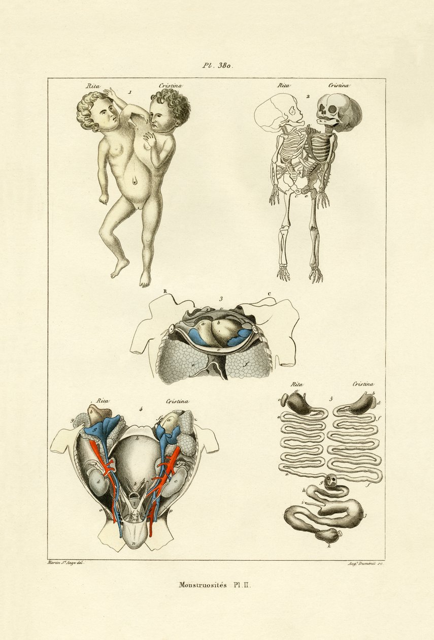 Freak, 1833-39 alkotó: French School