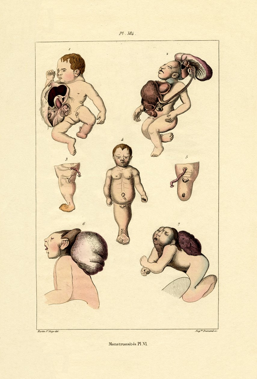Freak, 1833-39 alkotó: French School