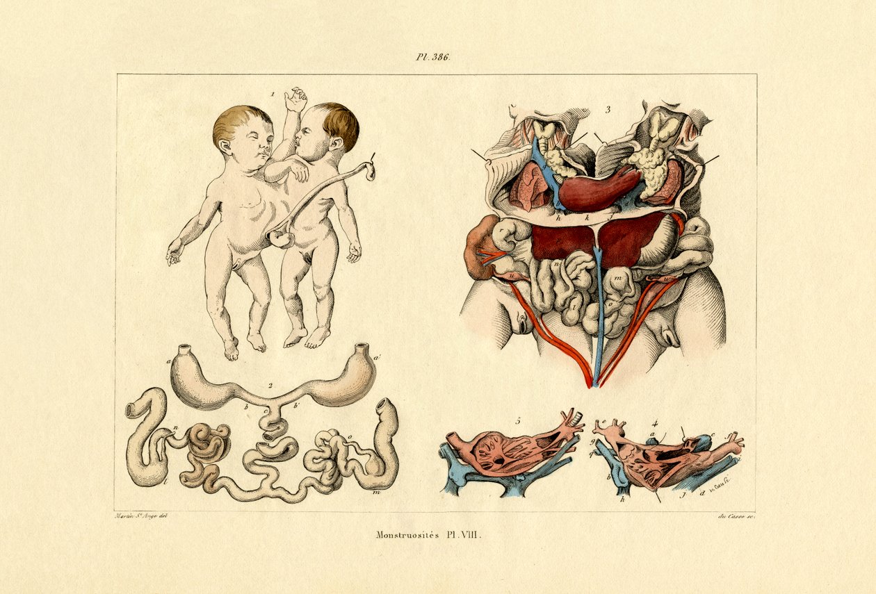 Freak, 1833-39 alkotó: French School