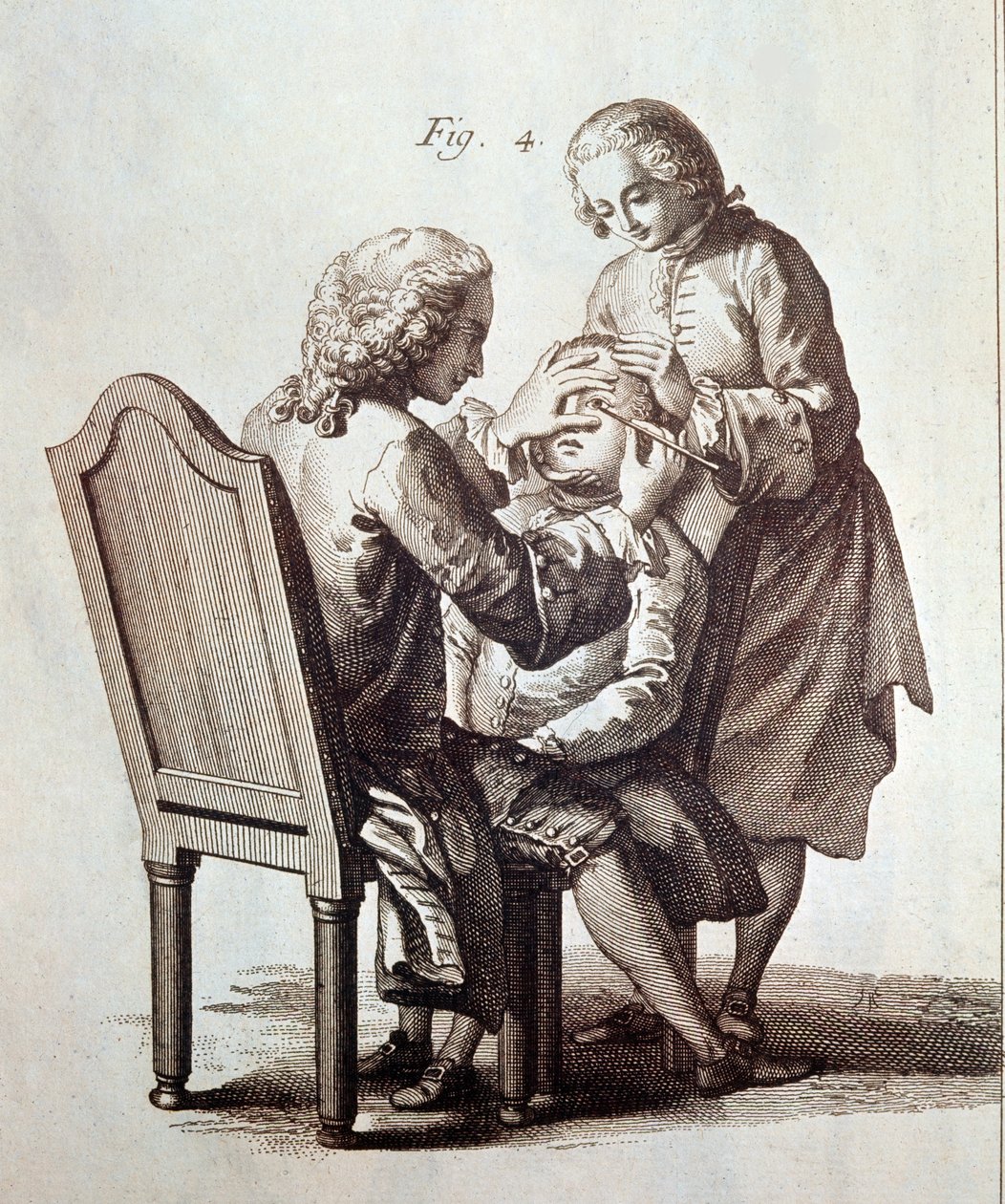 Egy orvos operál egy szürkehályogos beteget, illusztráció Denis Diderot és Jean le Rond d