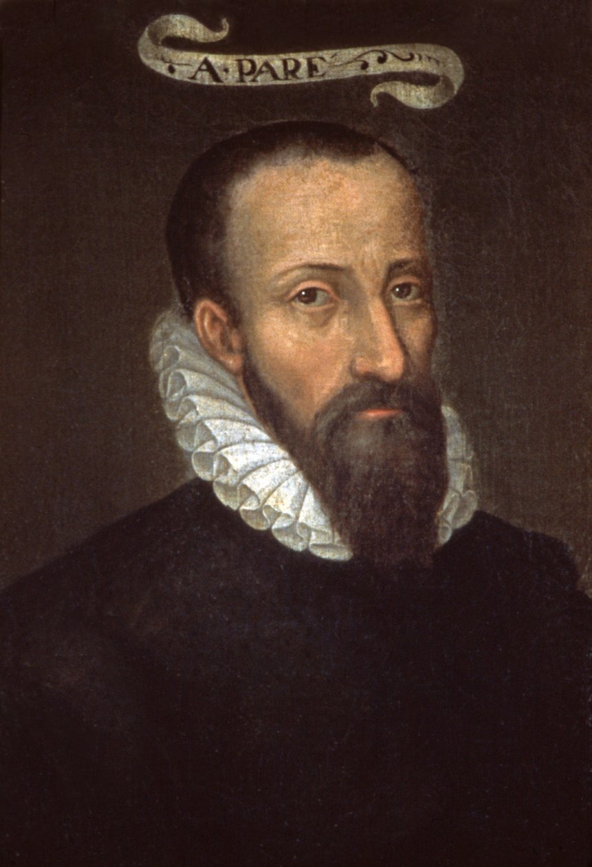 Ambroise Pare. 16. század (festmény) alkotó: French School