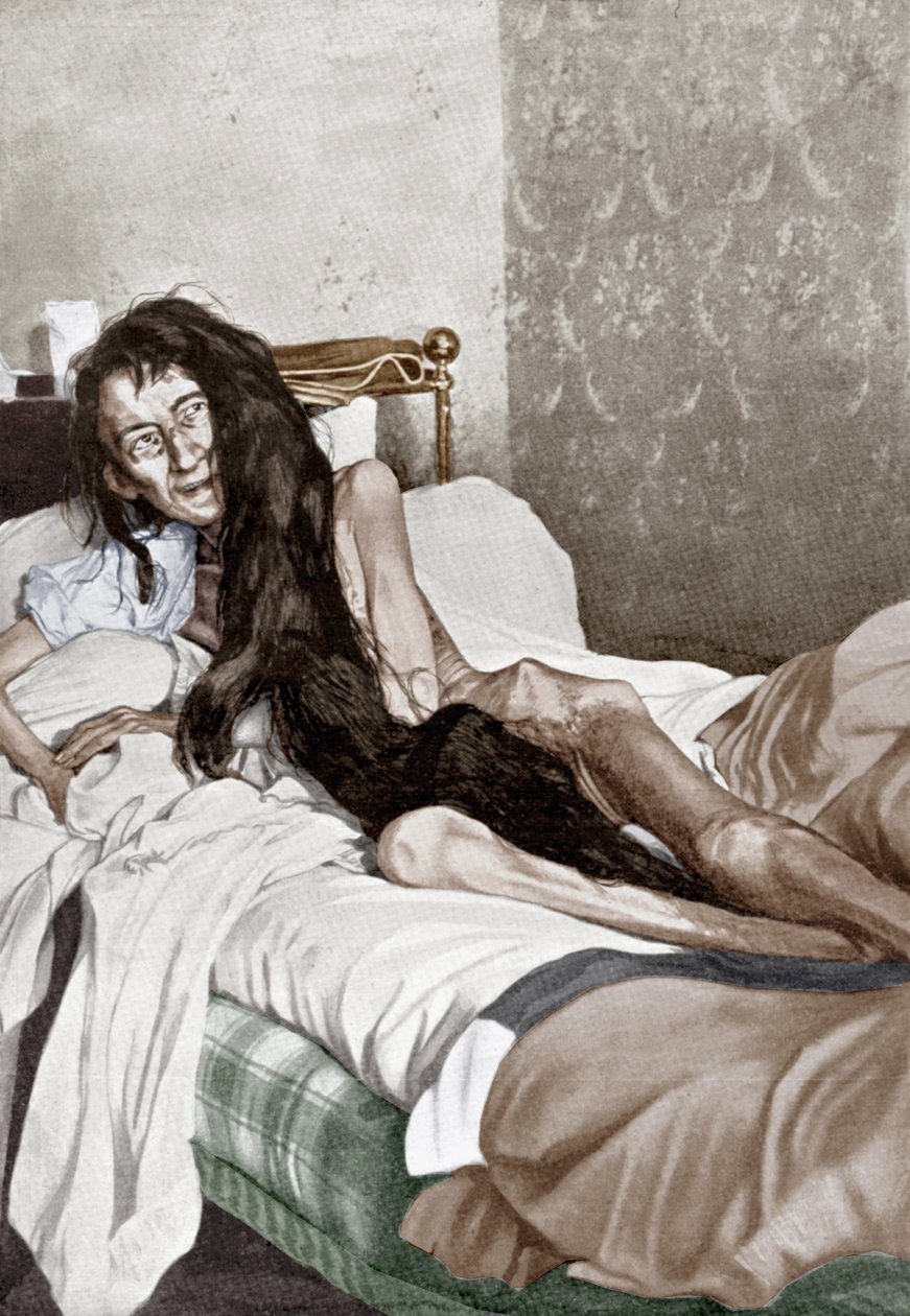 Blanche Monnier a kórházban, Poitiers, 1901. június (nyomtatás) alkotó: French School