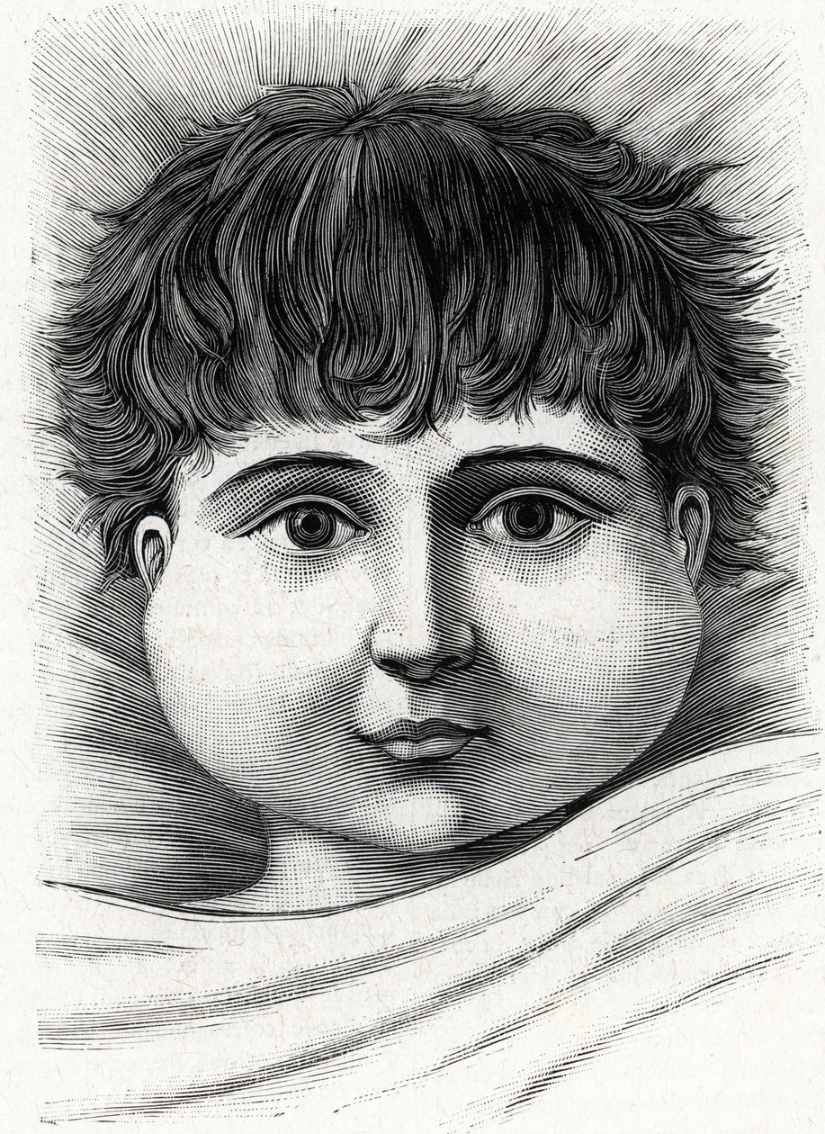 Mumpszos gyermek (metszet) 1888 alkotó: French School