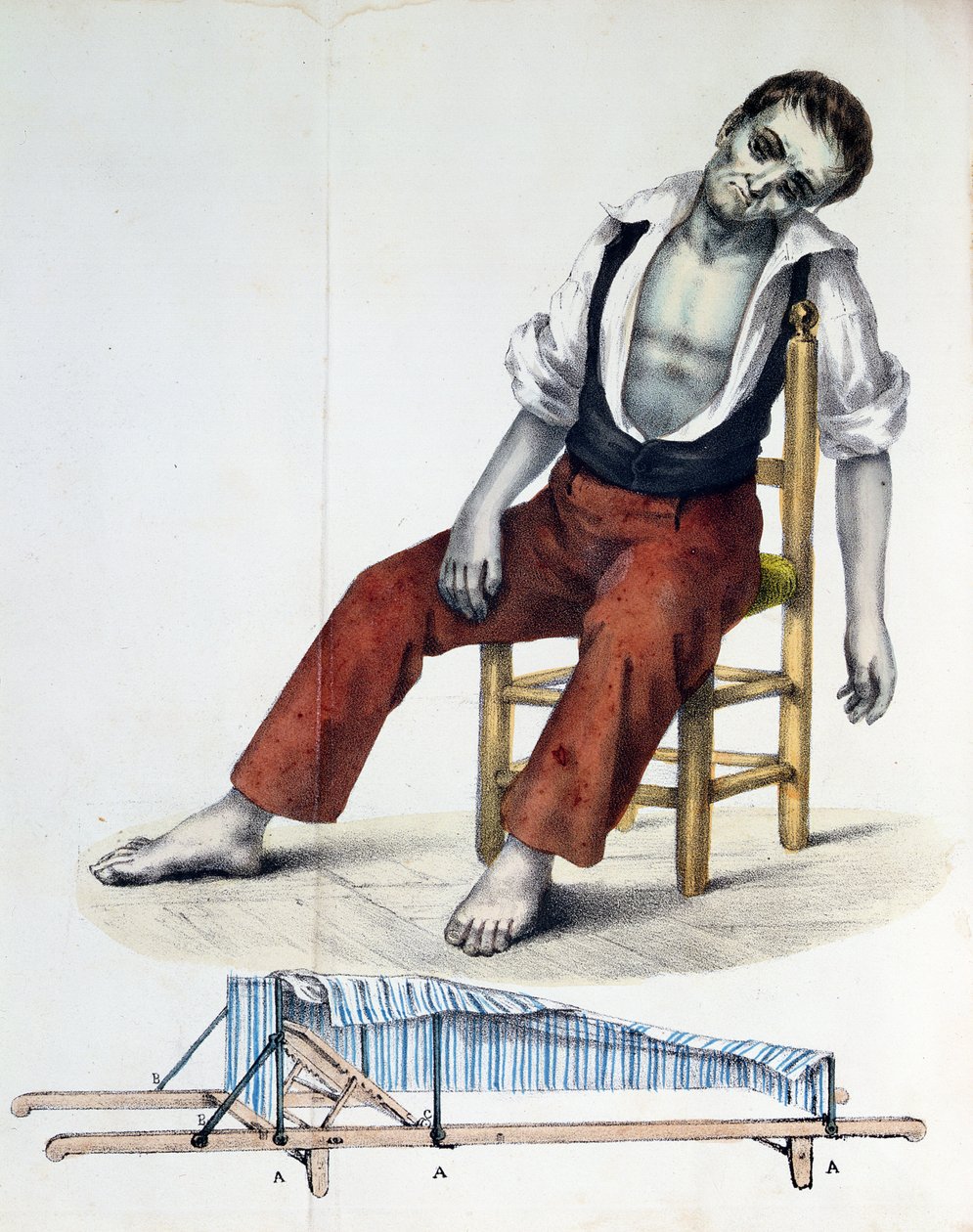 Cholera Morbus, a Cholera-Morbus kapcsolata, története, statisztikái és orvostudománya, Francisco dAssis de Souza Vaz, 1833 alkotó: French School