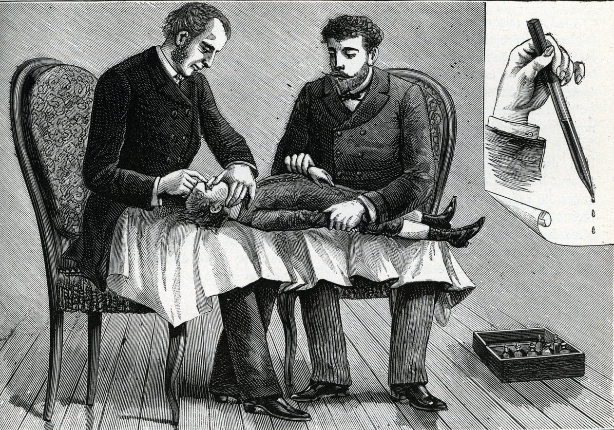 Orvosok, akik gyermekszemet vizsgálnak és szemcseppeket fecskendeznek be (metszet) 1888 alkotó: French School