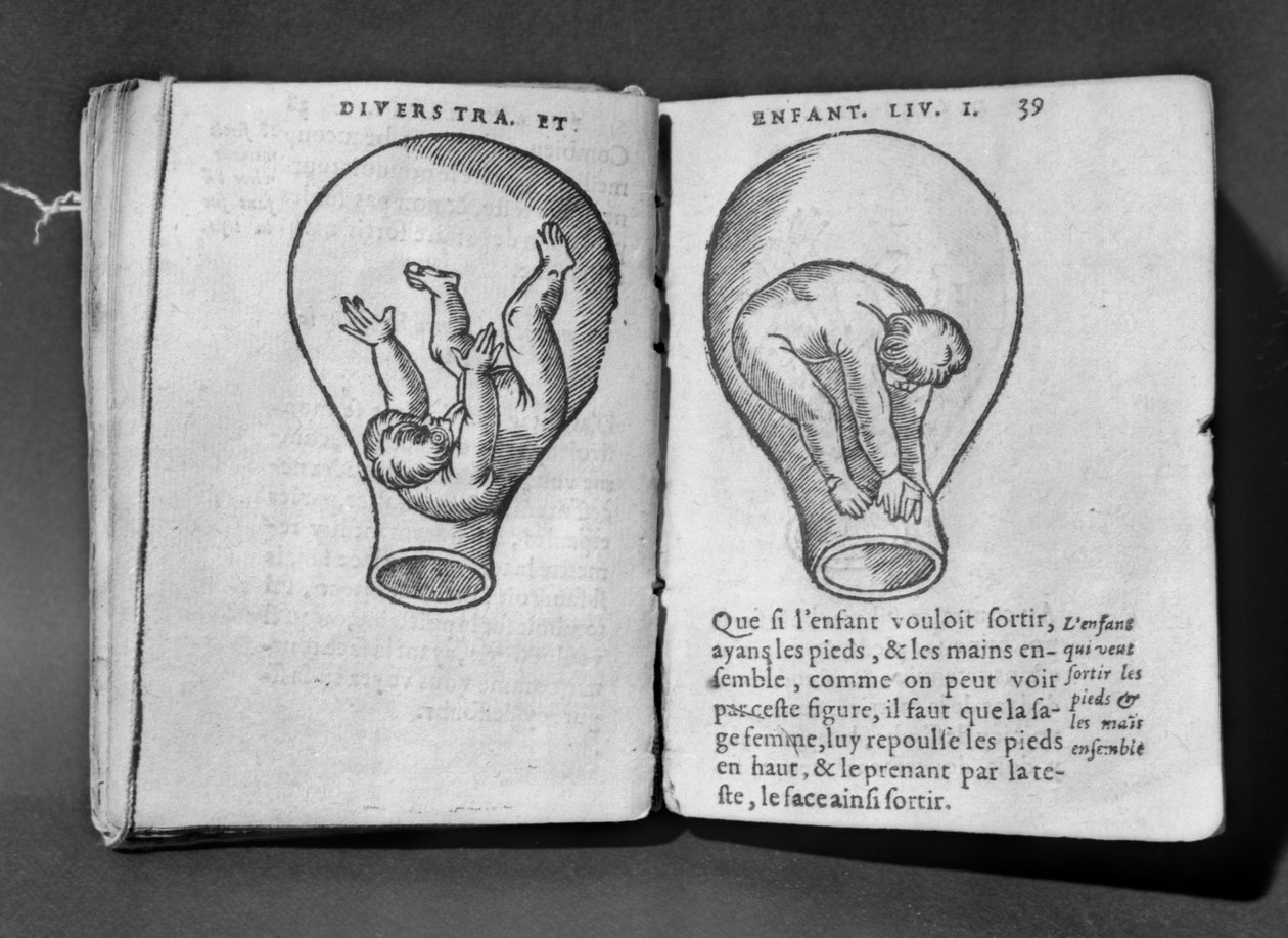 Magzat az anyaméhben, illusztráció az úgynevezett Rhodion kéziratból alkotó: French School