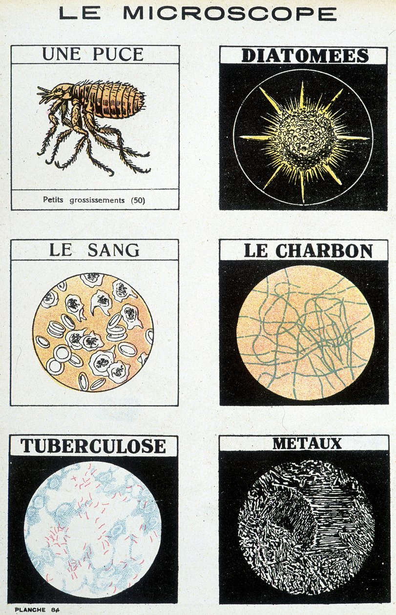 Mikroszkópok: chip, kovamoszat, vér, szén, tuberkulózis, fémek. alkotó: French School