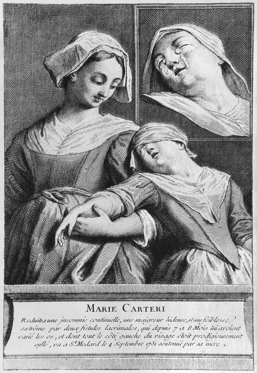 Egy vak nő, Marie Carteri csodálatos gyógyulása Francois de Paris diakónus sírján a párizsi Saint-Medard plébánia temetőjében alkotó: French School