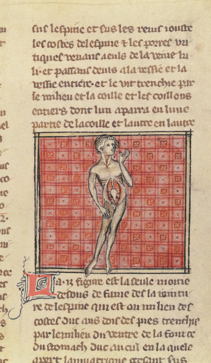 Ms 2030 fol.29 Anatómiai figura, Maitre Henri de Mondeville sebészetéből alkotó: French School
