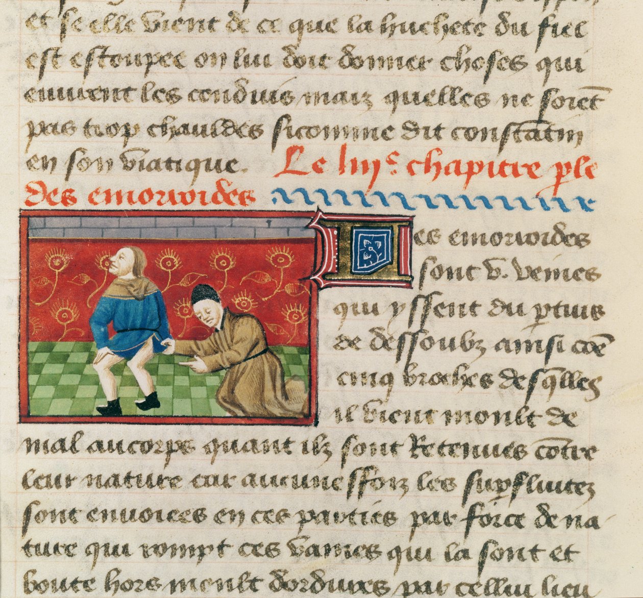 Ms 22532 Aranyéres beteg vizsgálata, Le Livre des Proprietes des Choses, Barthelemy lAnglais c. 1410-15 alkotó: French School
