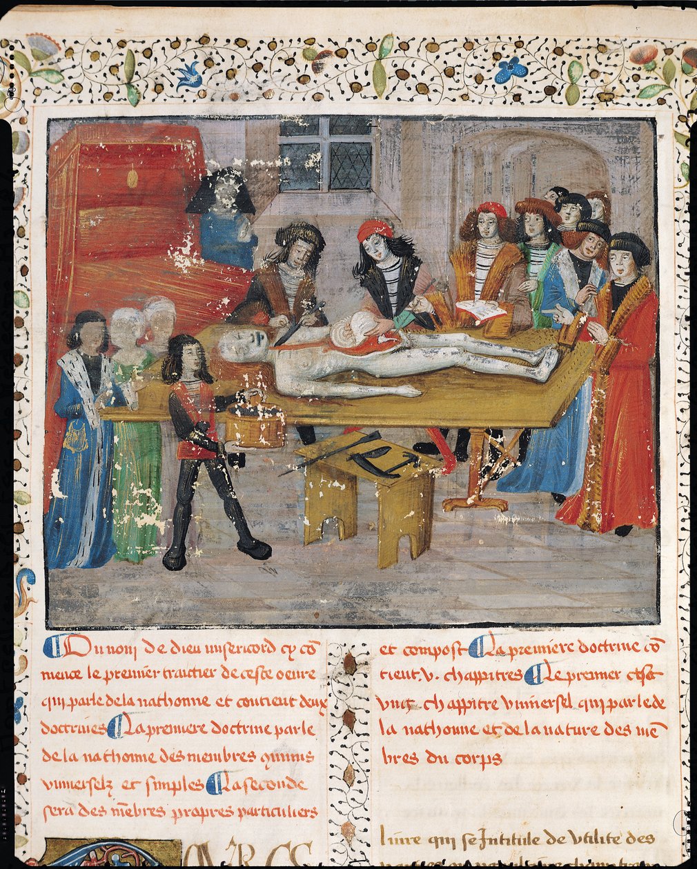Ms H 184 fol.14v Boncolási lecke a montpellier-i orvosi karon, Guy de Chauliac "La Grande Chirurgie" című művéből, 1363. alkotó: French School