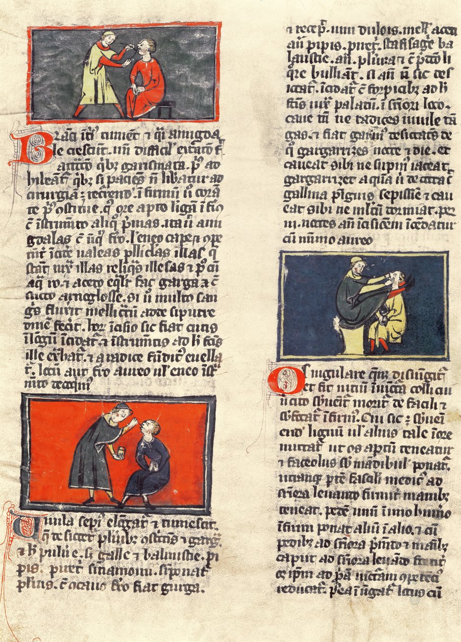 Ms H 89 fol.16v Dental Surgery, Rogier de Salerne „Sebészeti könyvének” kiadásából alkotó: French School