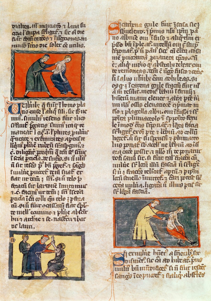 Ms H 89 fol.17r Surgery, Rogier de Salerne „Sebészet könyve” kiadásából alkotó: French School
