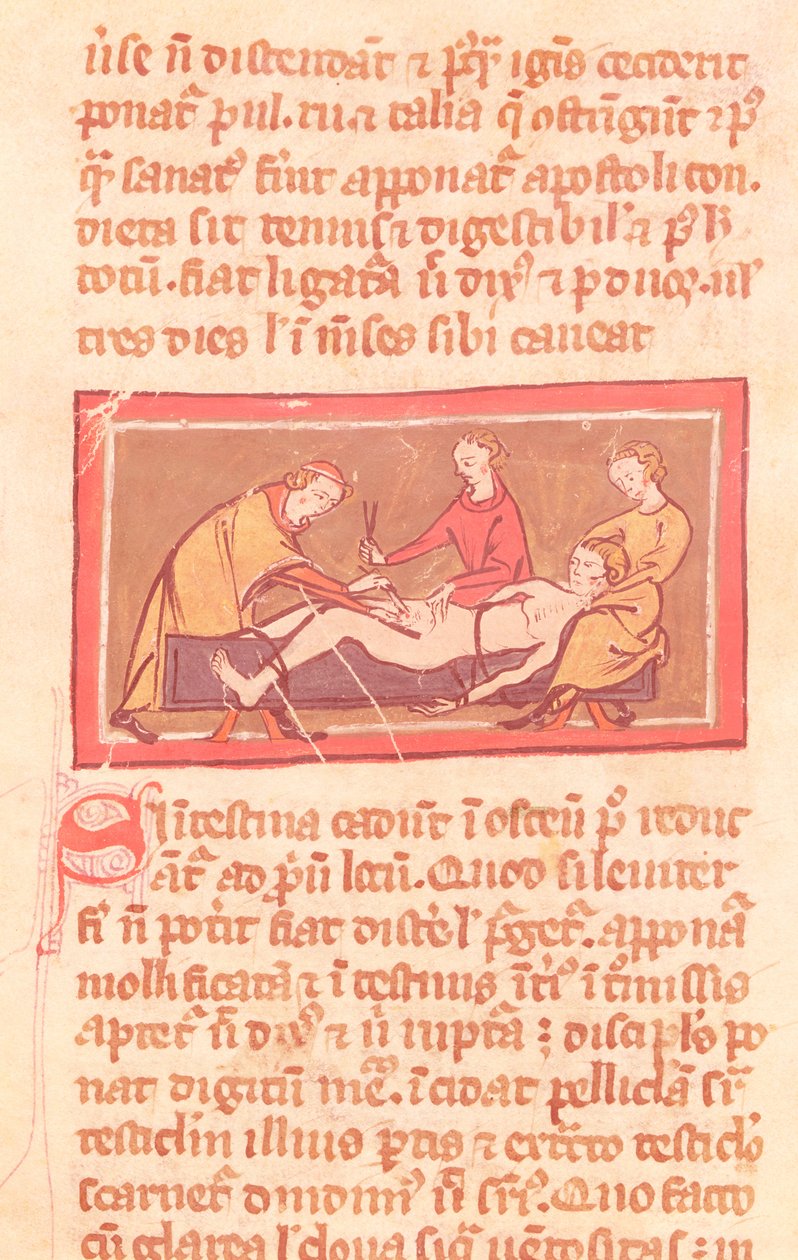 Ms H 89 fol.23 Surgery, Rogier de Salerne Sebészeti Könyvének egyik kiadásából alkotó: French School