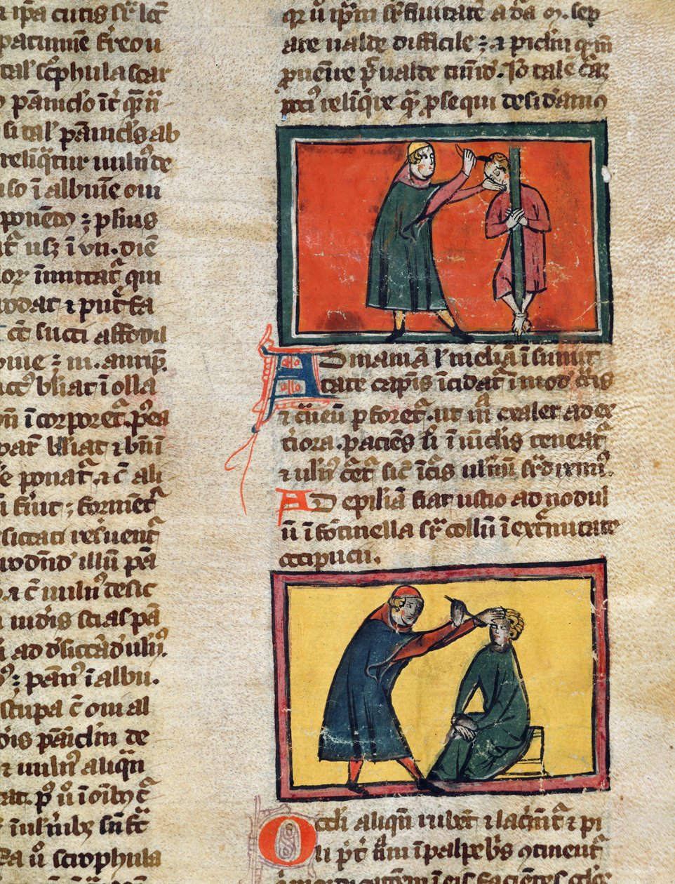 Ms H 89 fol.3 Betegeket kezelő orvosok, Rogier de Salerne Book of Surgery című könyvének kiadásából alkotó: French School