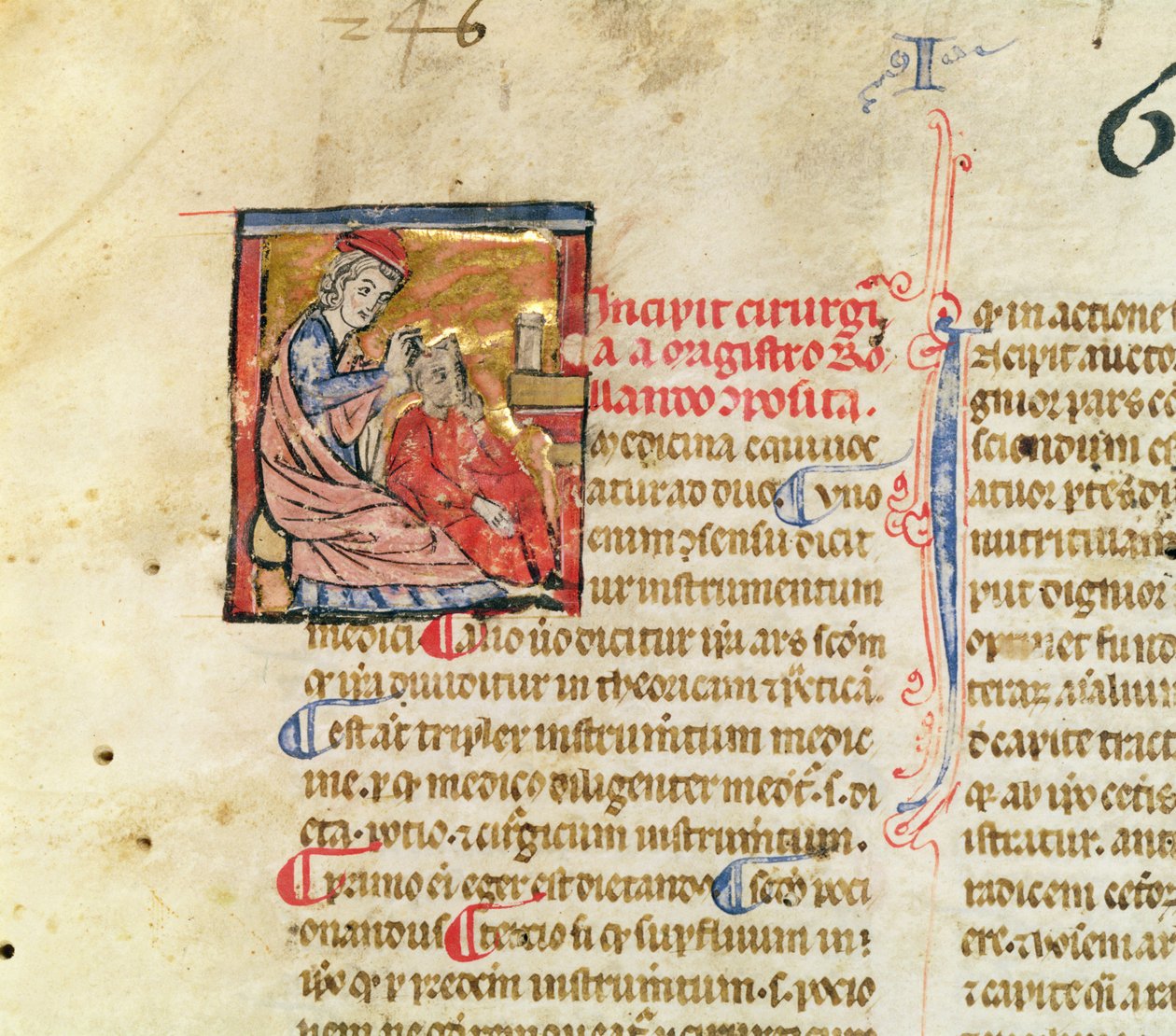 Ms Lat. 7134 fol.1 Trepanáció, a sebészetből, Maitre Rolandi alkotó: French School
