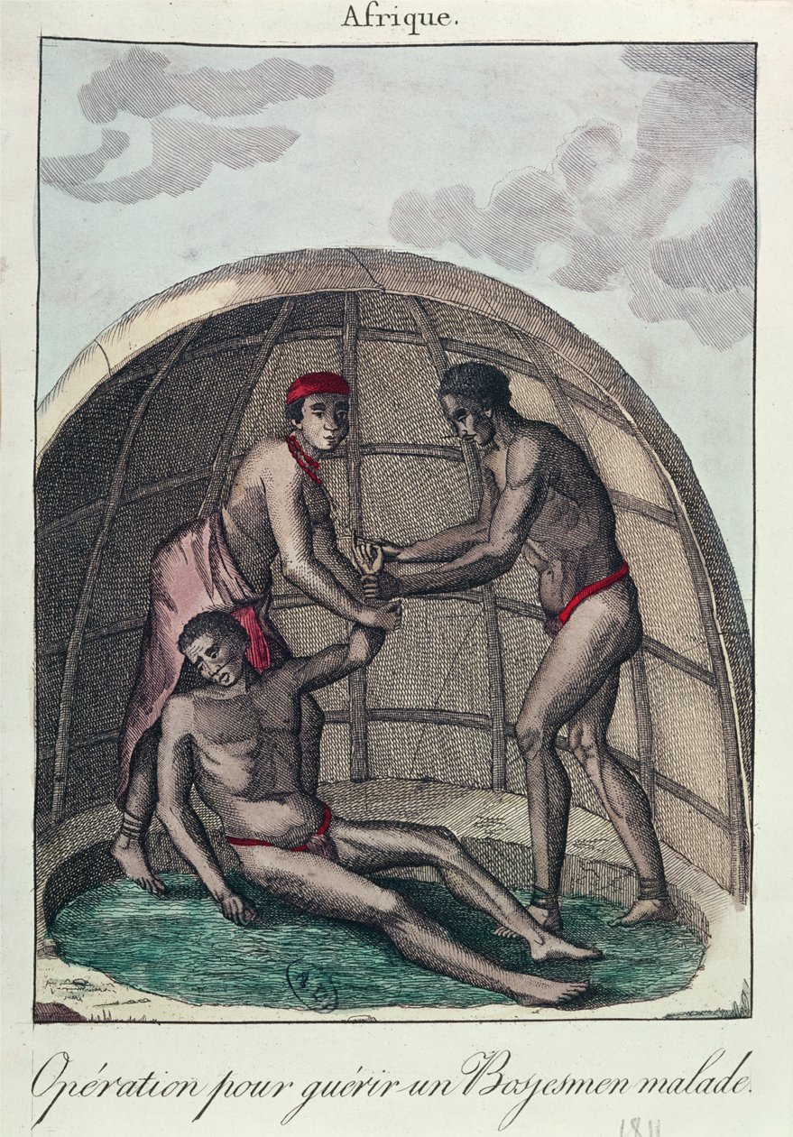 Műtét egy beteg busman gyógyítására, 1811 (színes metszet) alkotó: French School