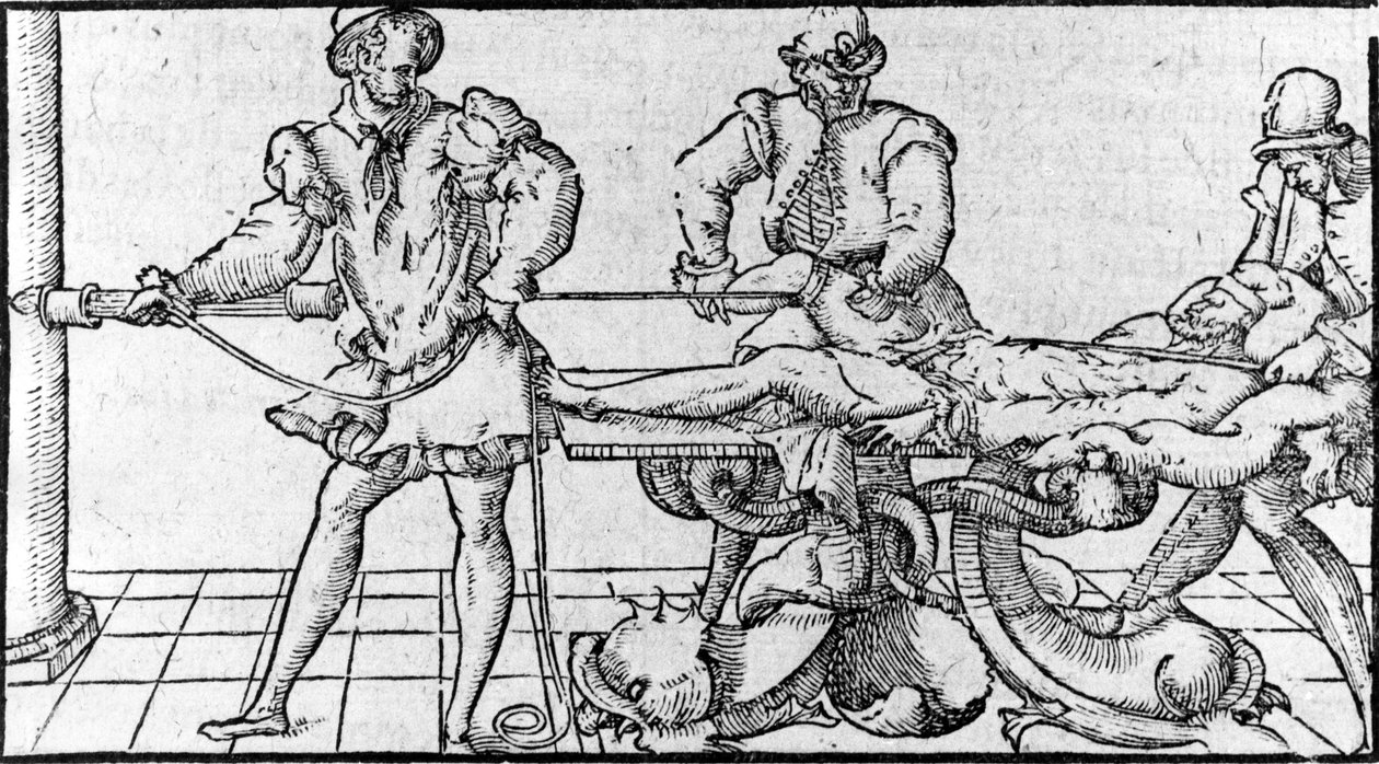 A diszlokáció csökkentése, „Ambroise Paré orvosi szerződése”, 1560 körül. alkotó: French School