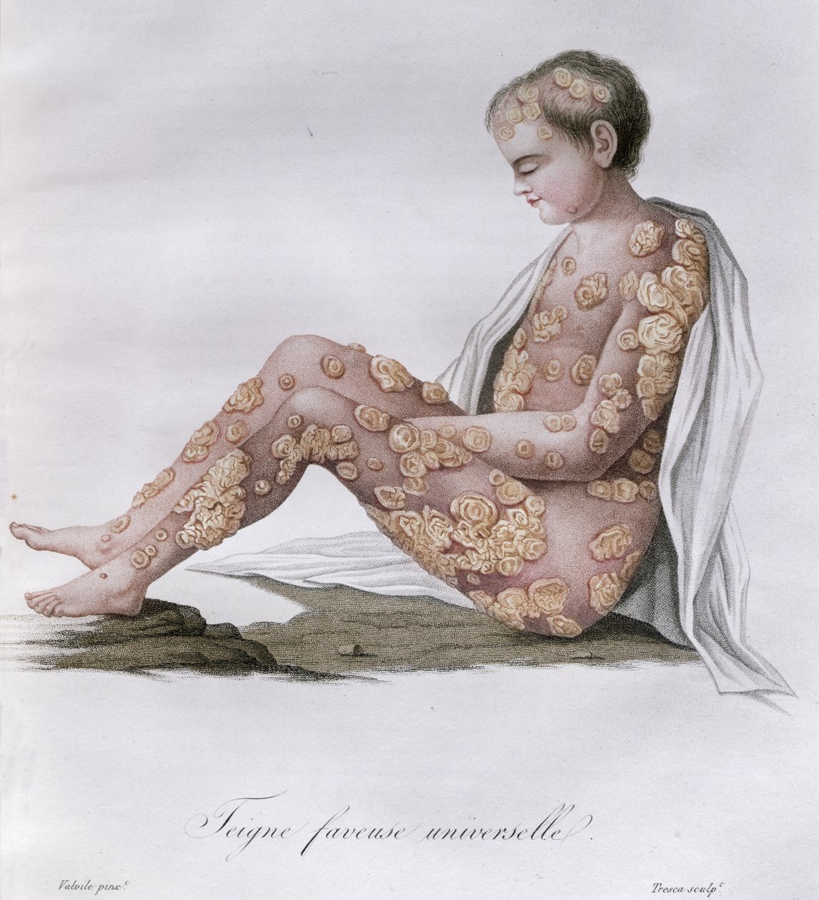 Ótvar, báró Jean Louis Alibert (1768-1837) könyvéből, 1838 alkotó: French School