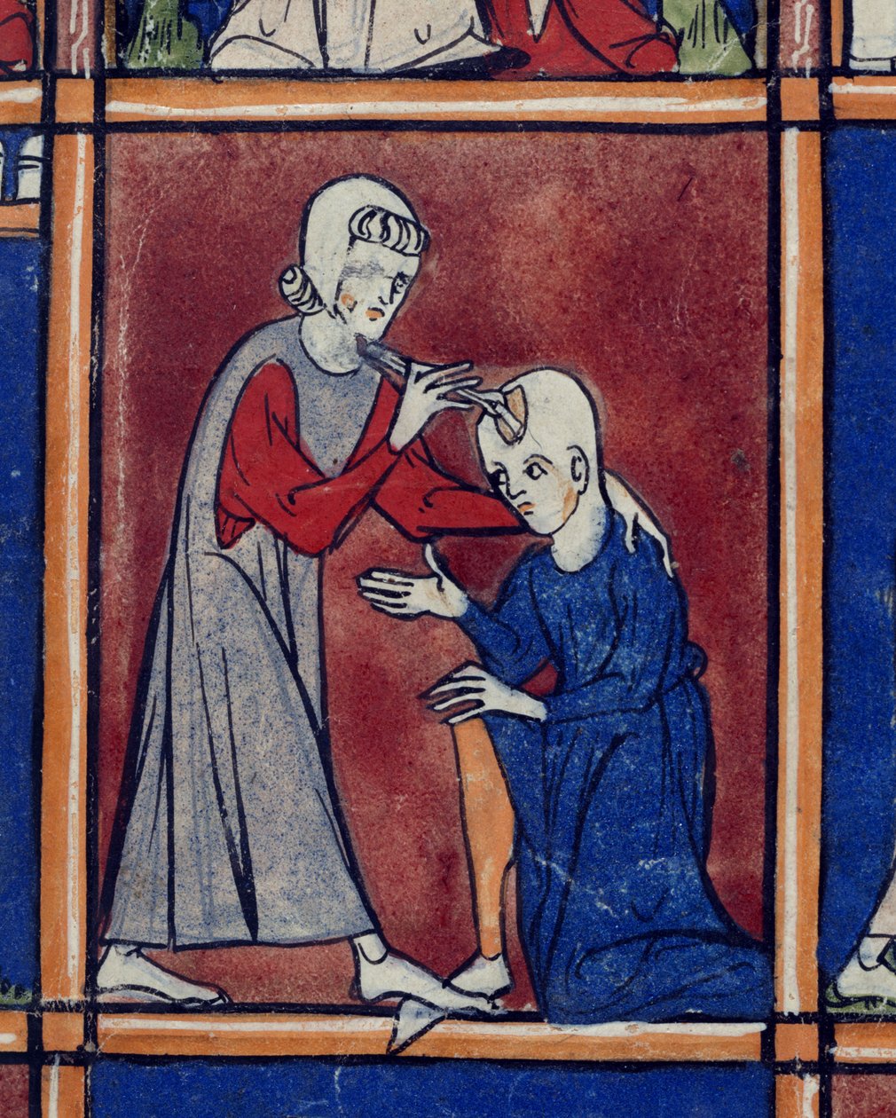 Sloane 1977 f.2 Operáció egy páciens koponyáján, illusztráció a „Chiurgia”-ból, Roger Frugardi, Párma, 1300-10 körül (vellum) alkotó: French School