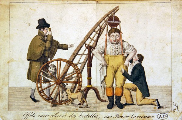 "The Wonderful Effects of Braces", 1790 körül (színes litó) alkotó: French School