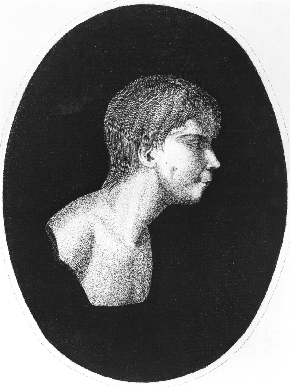 Victor of Aveyron, a De lEducation dun homme sauvage előlapja, J.E.Itard alkotó: French School