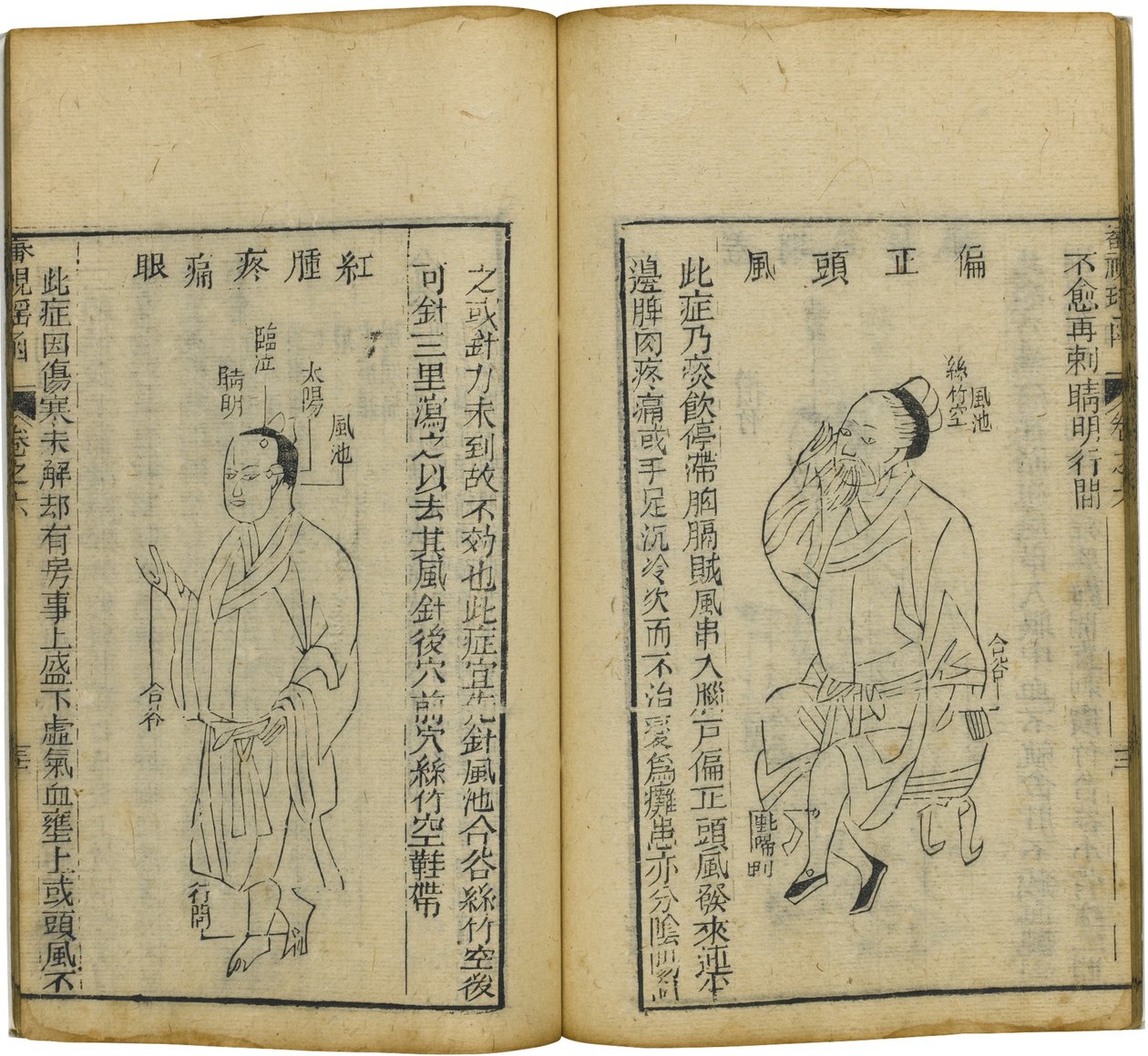 Shen Shi Yao Han A szemészet értékes könyve, 1644 alkotó: Fu Renyu