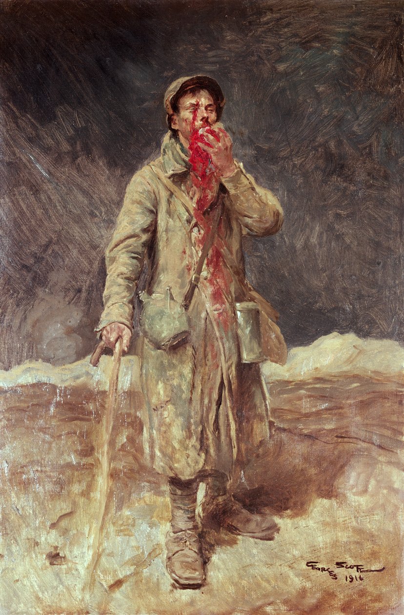 Egy sérült katona, 1916 alkotó: Georges Bertin Scott