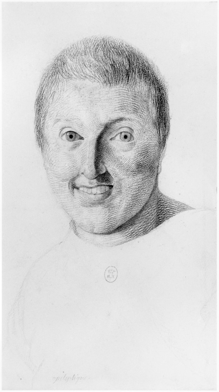 Epilepsziás nő, elölnézet, illusztráció Jean Etienne Dominique Esquirol (1772-1840) kiadatlan értekezéséből a Salpetriere menedékház őrültjeiről, 1818 körül alkotó: Georges Francois Gabriel
