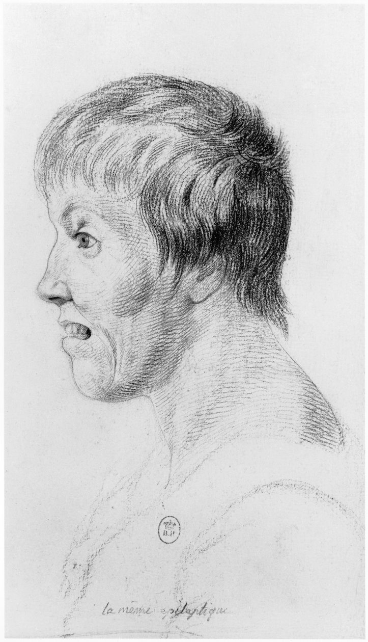 Epilepsziás nő, profil, illusztráció Jean Etienne Dominique Esquirol (1772-1840) kiadatlan értekezéséből a Salpetriere menedékház őrültjeiről, 1818 körül alkotó: Georges Francois Gabriel