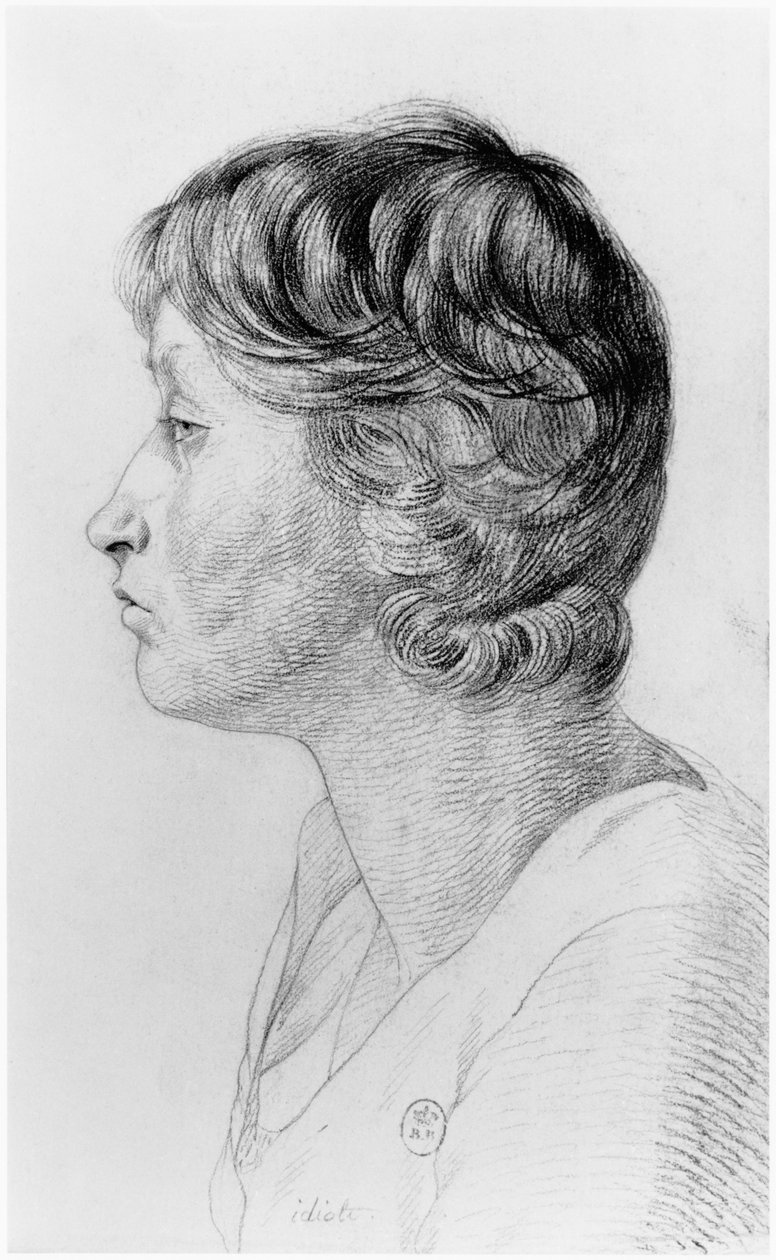 Idióta, illusztráció Jean Etienne Dominique Esquirol (1772-1840) kiadatlan értekezéséből a Salpetriere menedékház őrültjeiről, 1818 körül alkotó: Georges Francois Gabriel
