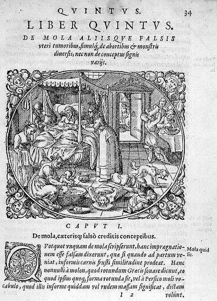 Születés után, illusztráció Rueff „Az ember fogantatásáról és növekedéséről” 5. könyvének 1. fejezetéből alkotó: German School