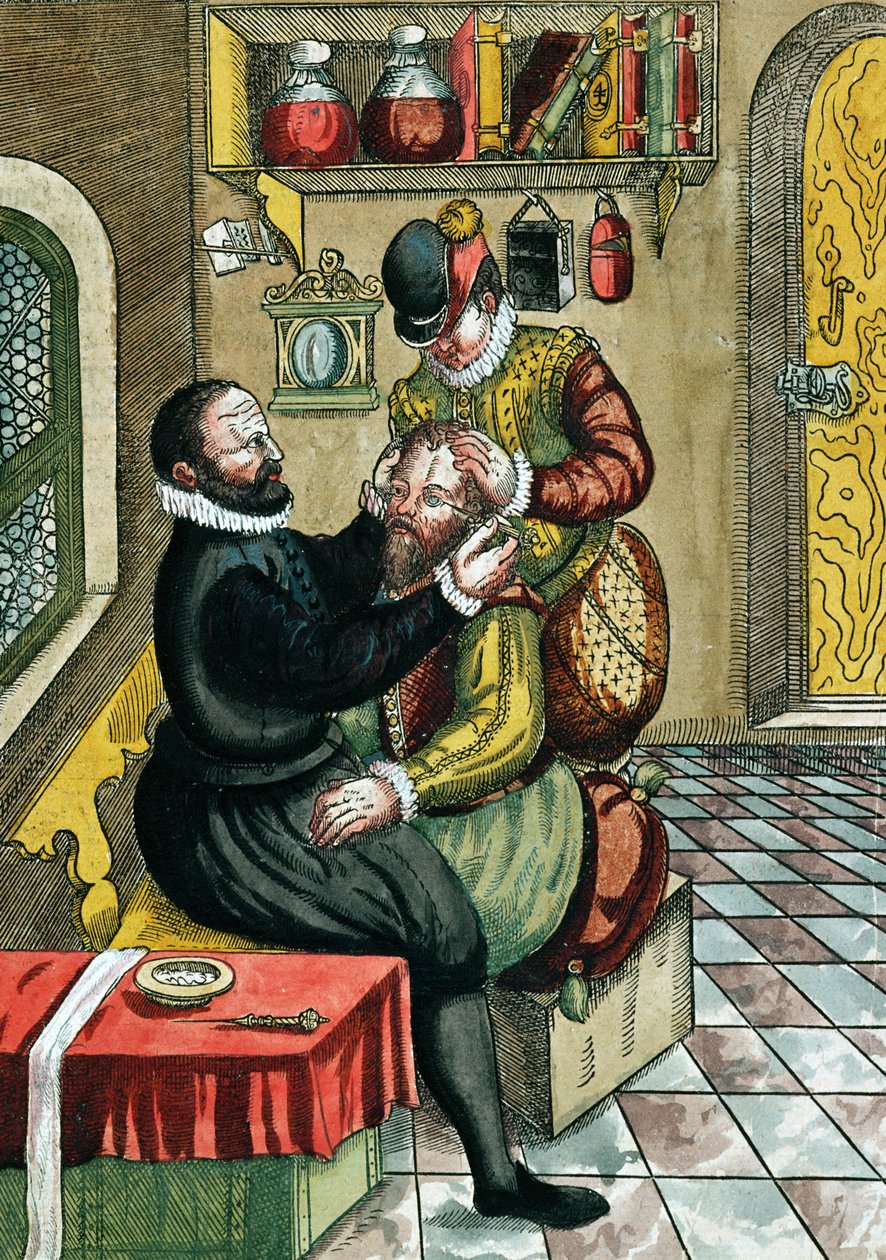 Szürkehályog műtét, az Ophthalmodouleia-ból Georg Bartisch (1535-1636) Drezdában 1583-ban (színes fatömbnyomat) alkotó: German School