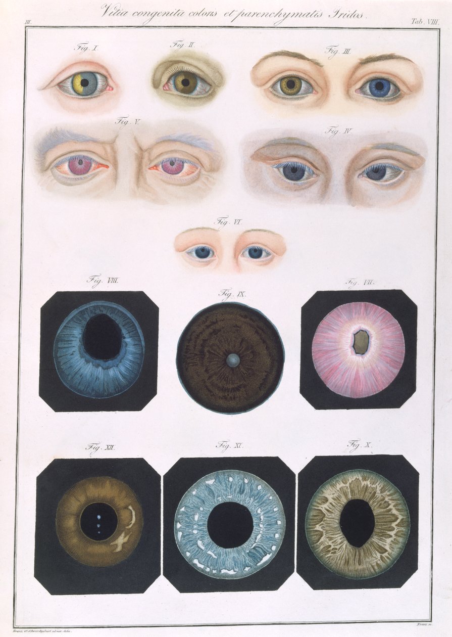A veleszületett szem anomáliák leírása az emberi szem betegségeinek és látáshibáinak klinikai bemutatásából, Friedrich August von Ammon (1799-1861) 1838 alkotó: German School