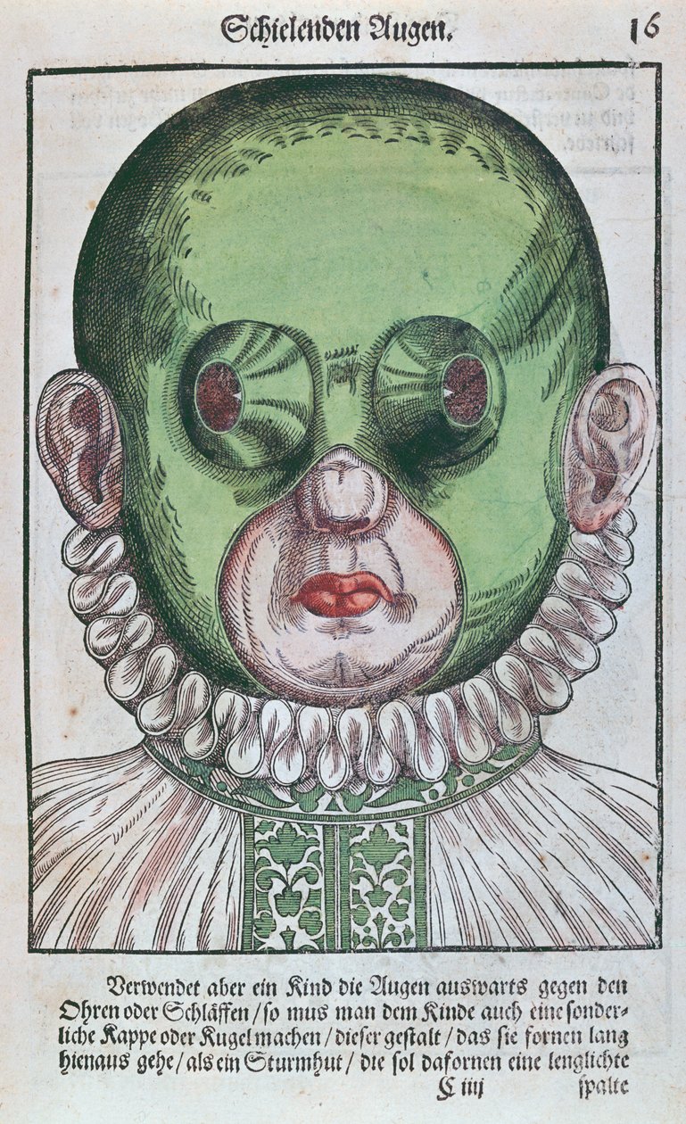 Maszk strabismus kezelésére, Georg Bartisch (1535-1636) Ophthalmodouleia-ból, Drezdában 1583-ban (színes fatömbnyomat) alkotó: German School