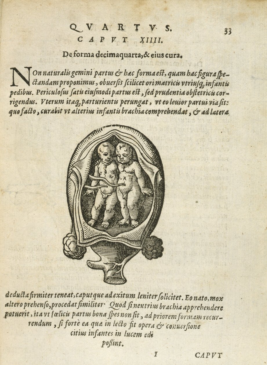 Nem egypetéjű ikrek az anyaméhben, illusztráció a 14. fejezetből, Rueff Az ember fogantatásáról és növekedéséről, 1587. alkotó: German School