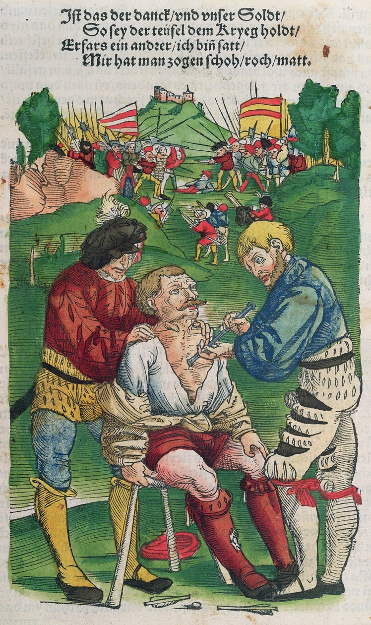 Nyíl eltávolítása, Feldtbuch der Wundartzney illusztrációja, Hans von Gersdorff, 1540 alkotó: German School