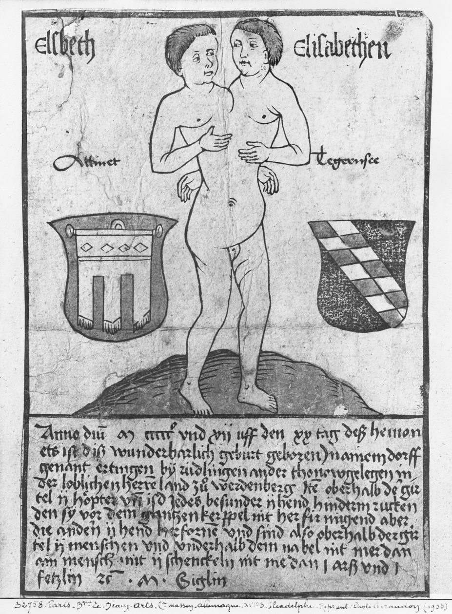 Sziámi lányok, Elsbeth és Elisabethen (fametszet és wc) alkotó: German School