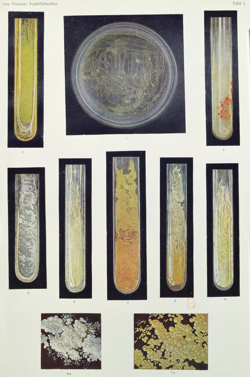 Syphilis Bacillus, Max von Niessen könyvéből, Lipcse, 1908 alkotó: German School
