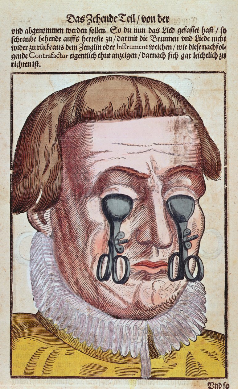Szembetegség kezelése, Georg Bartisch (1535-1636) Ophthalmodouleia-ból, Drezdában 1583-ban (színes fatömbnyomat) alkotó: German School