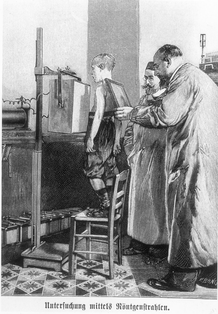 Wilhelm Konrad Roentgen (1845-1923) egy fiatal fiút röntgenez, Hans Kraemer könyvéből, 1898-99 körül alkotó: German School
