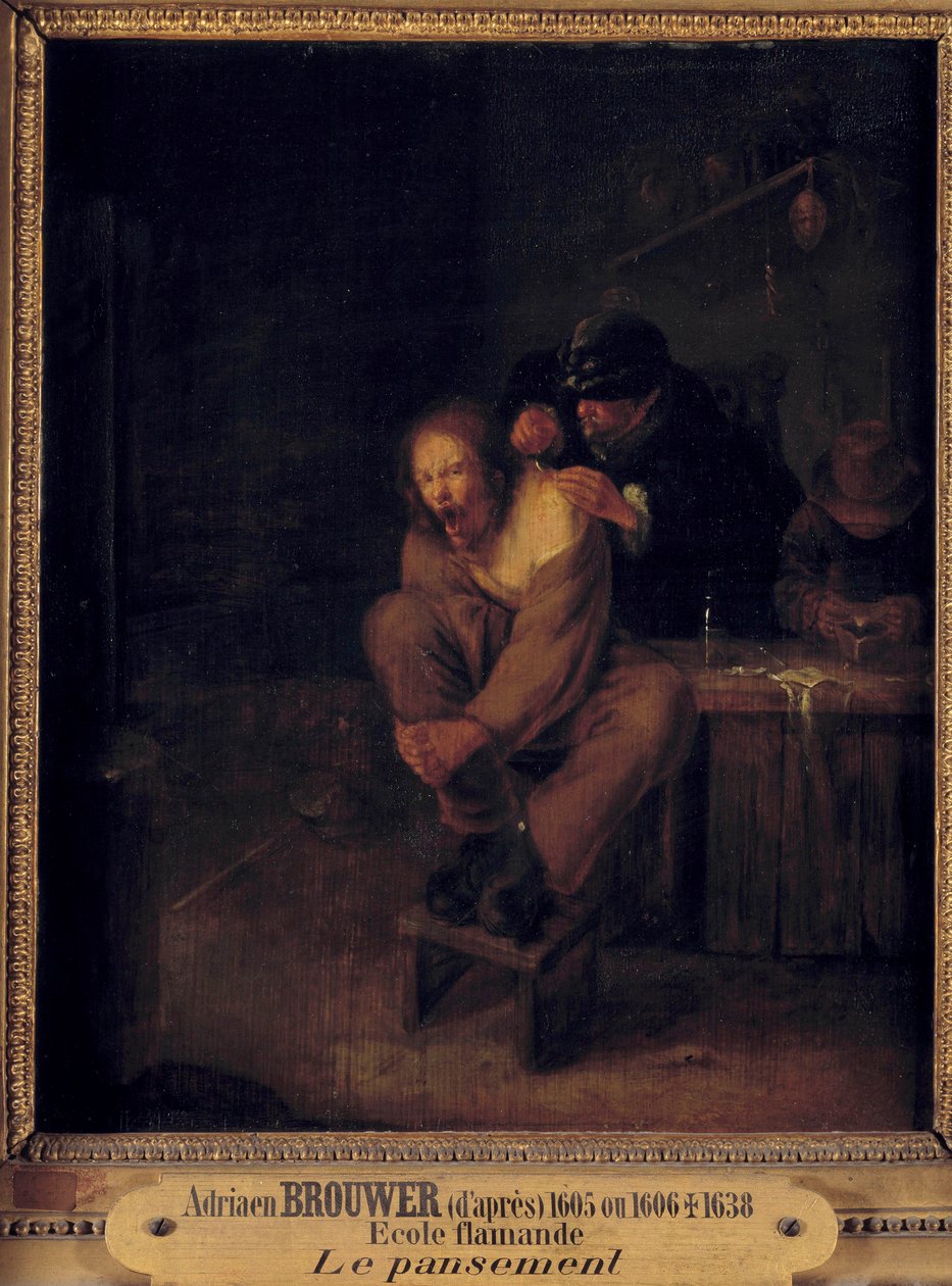 Műtét (vagy öltözködés) A pácienst ápoló sebész. Gerrit Lundens (1622-1683) festménye Adriaen Brouwer (1605/1606-1638) nyomán. 17. század. Homályos. 0,32x0,28 m. alkotó: Gerrit Lundens