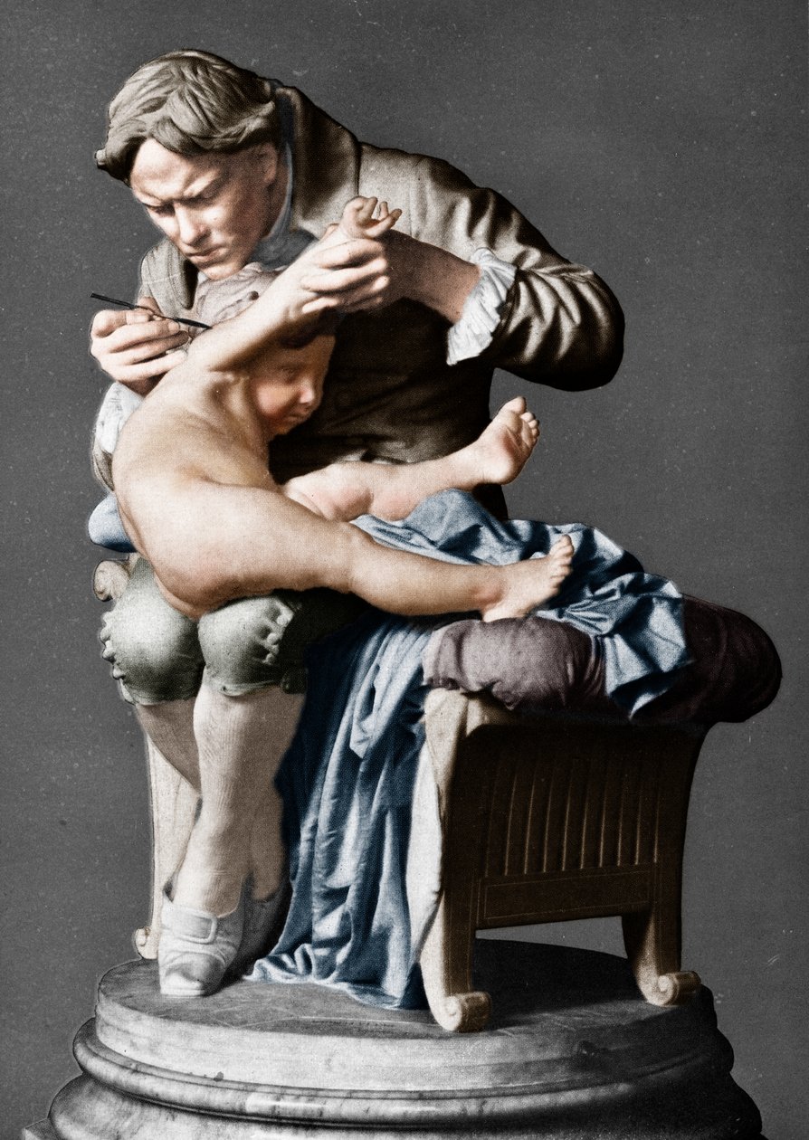 Edward Jenner angol orvos, fiát oltja be, c1796 c1900. alkotó: Giulio Monteverde