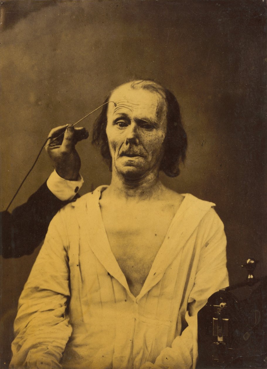 Nyugodt arc (balra); elmélyült figyelem (jobbra),1854-1856, nyomtatva 1862 (fotó) alkotó: Guillaume Benjamin Armand Duchenne de Boulogne