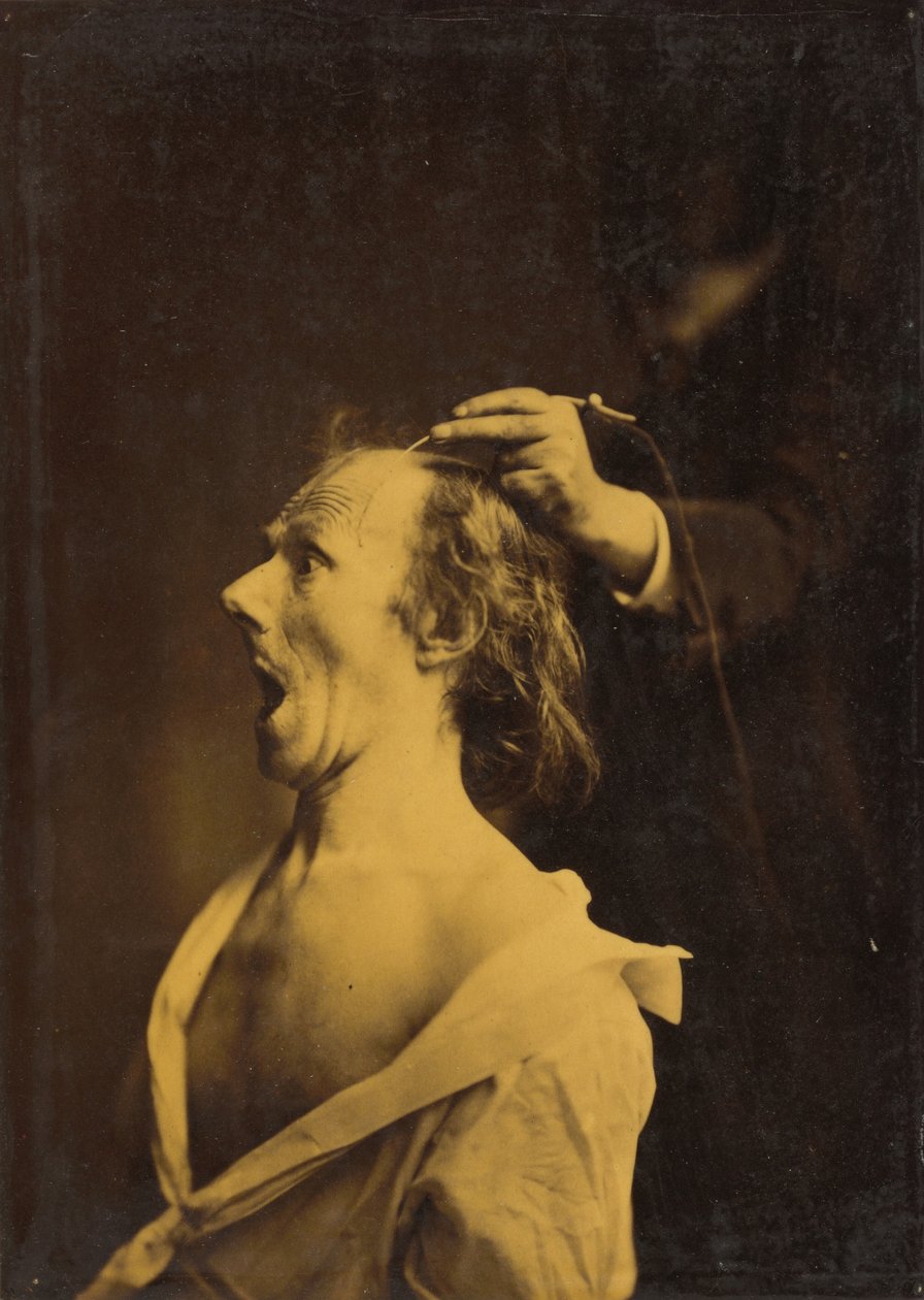 Megdöbbenés, döbbenet, csodálkozás,1854-1856, nyomtatva 1862 (fotó) alkotó: Guillaume Benjamin Armand Duchenne de Boulogne