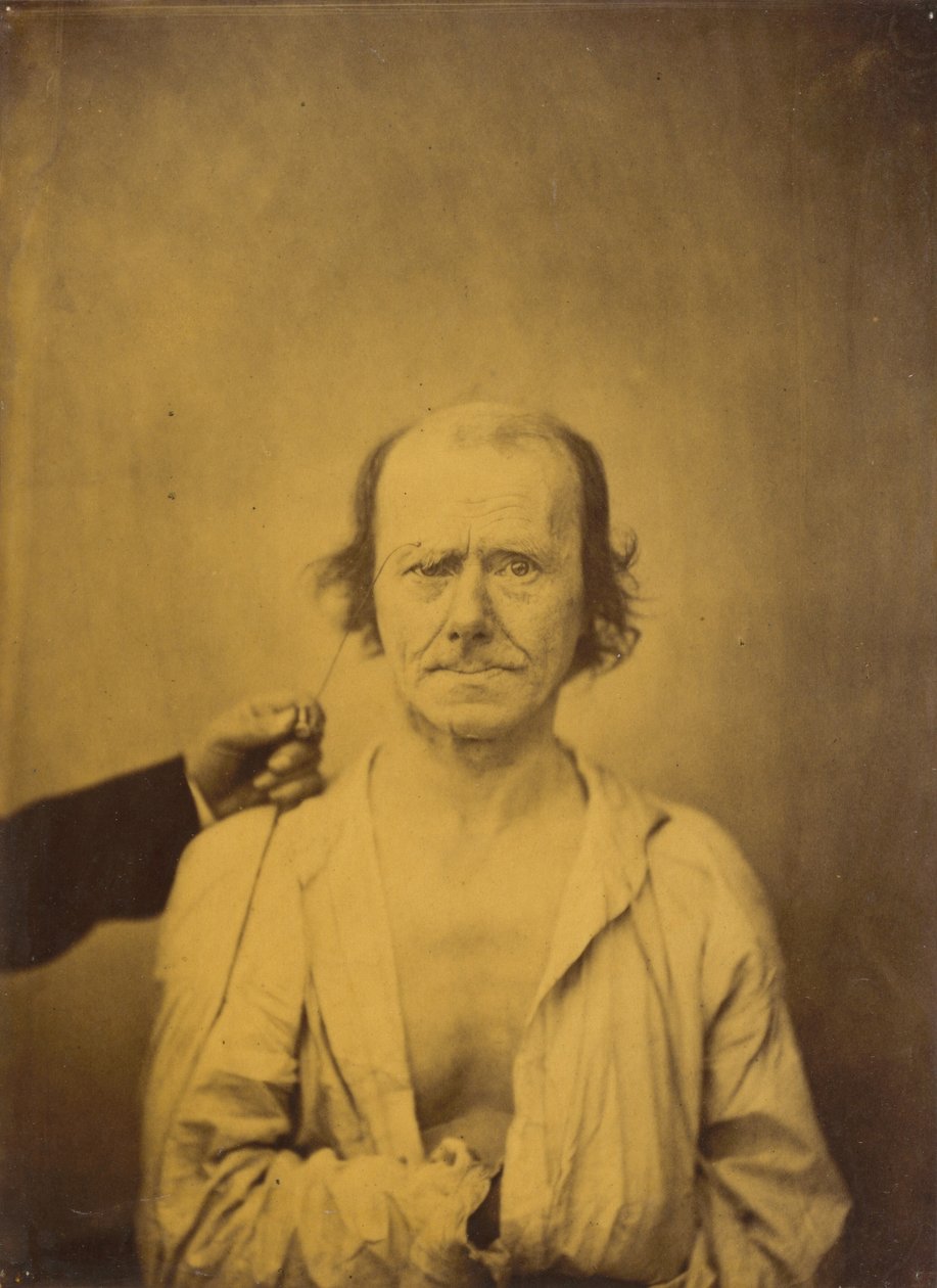 Figyelem (balra); Tükörkép (jobbra),1854-1856, nyomtatva 1862 (fotó) alkotó: Guillaume Benjamin Armand Duchenne de Boulogne